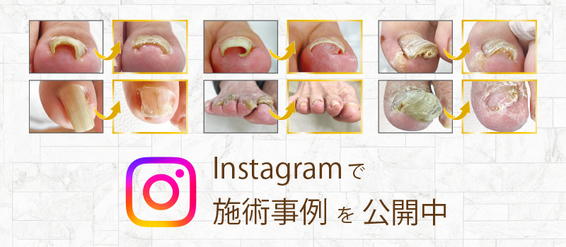 インスタ